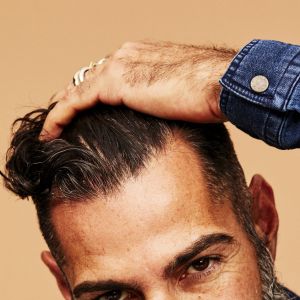 Does Minoxidil Work For a Receding Hairline? | hims